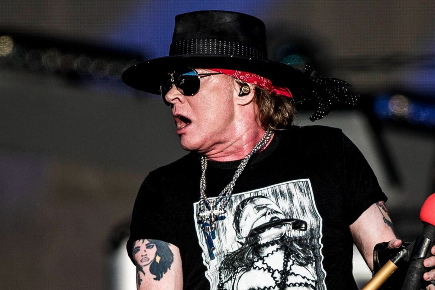 Axel Rose has been having voice problems lately.