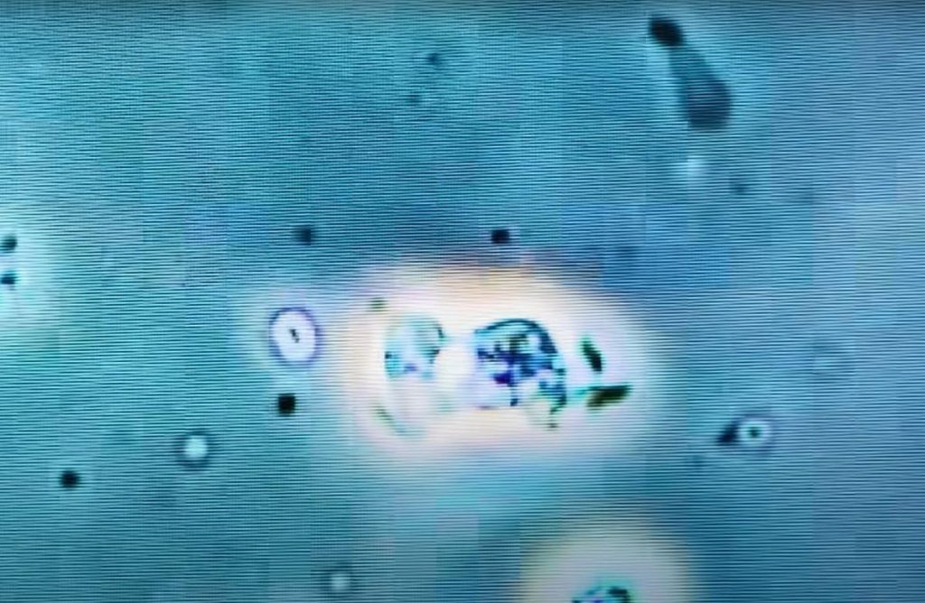 scary ?  There is a "brain-eating" amoeba, a teenager was killed in the United States